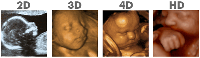 ultrasound clinics dallas Blooming Baby 3D/4D/HD Ultrasound Studio