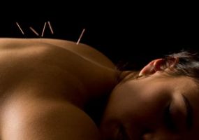 acupuncture fertility dallas Southwest Acupuncture Clinic