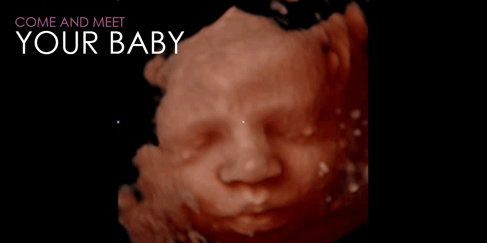 ultrasound clinics dallas Little Bellies Ultrasound & Pregnancy Spa