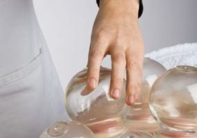 Southwest Acupuncture Clinic - cupping